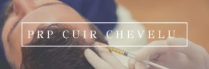 PRP cuir chevelu