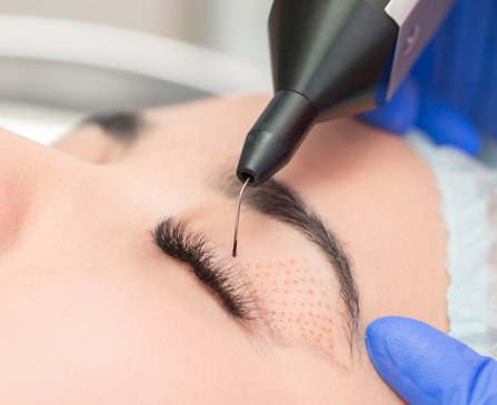 blépharoplastie médicale