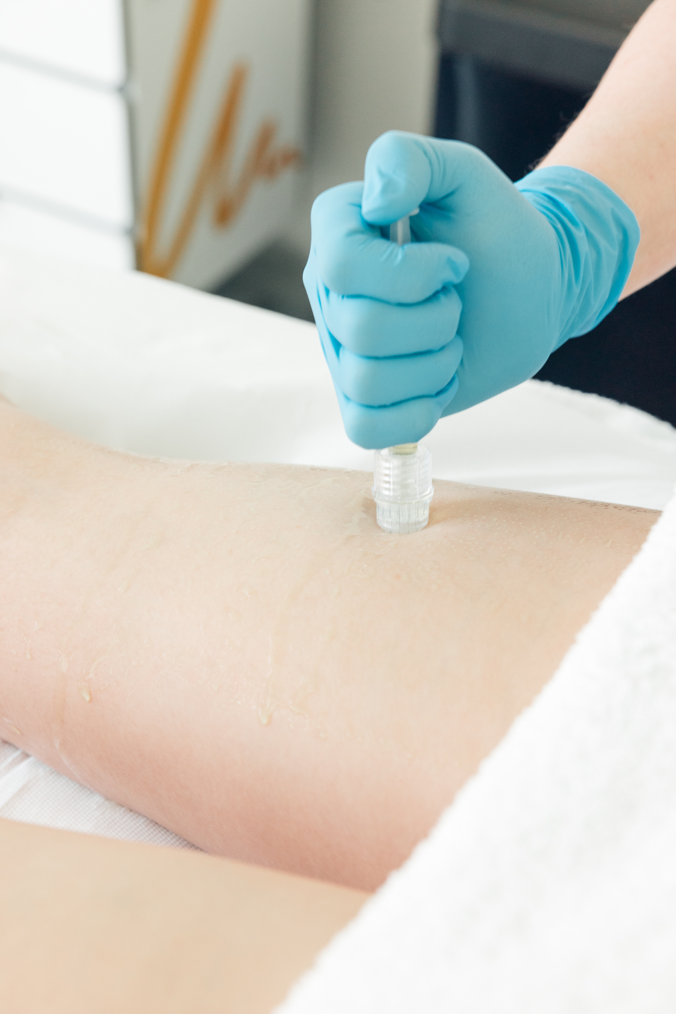 Anti Cellulite Mesotherapy - Forever Institut Anti Cellulite Mesotherapy - Forever Institut
