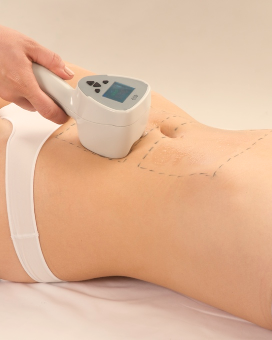 Exilis Ultrasound & radiofrequency treatment | Forever Institut